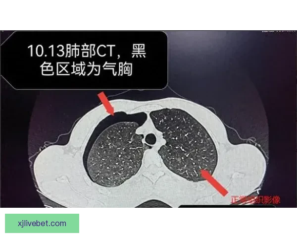 坎宁安气胸恢复顺利 活塞官方公布复查时间和复出计划